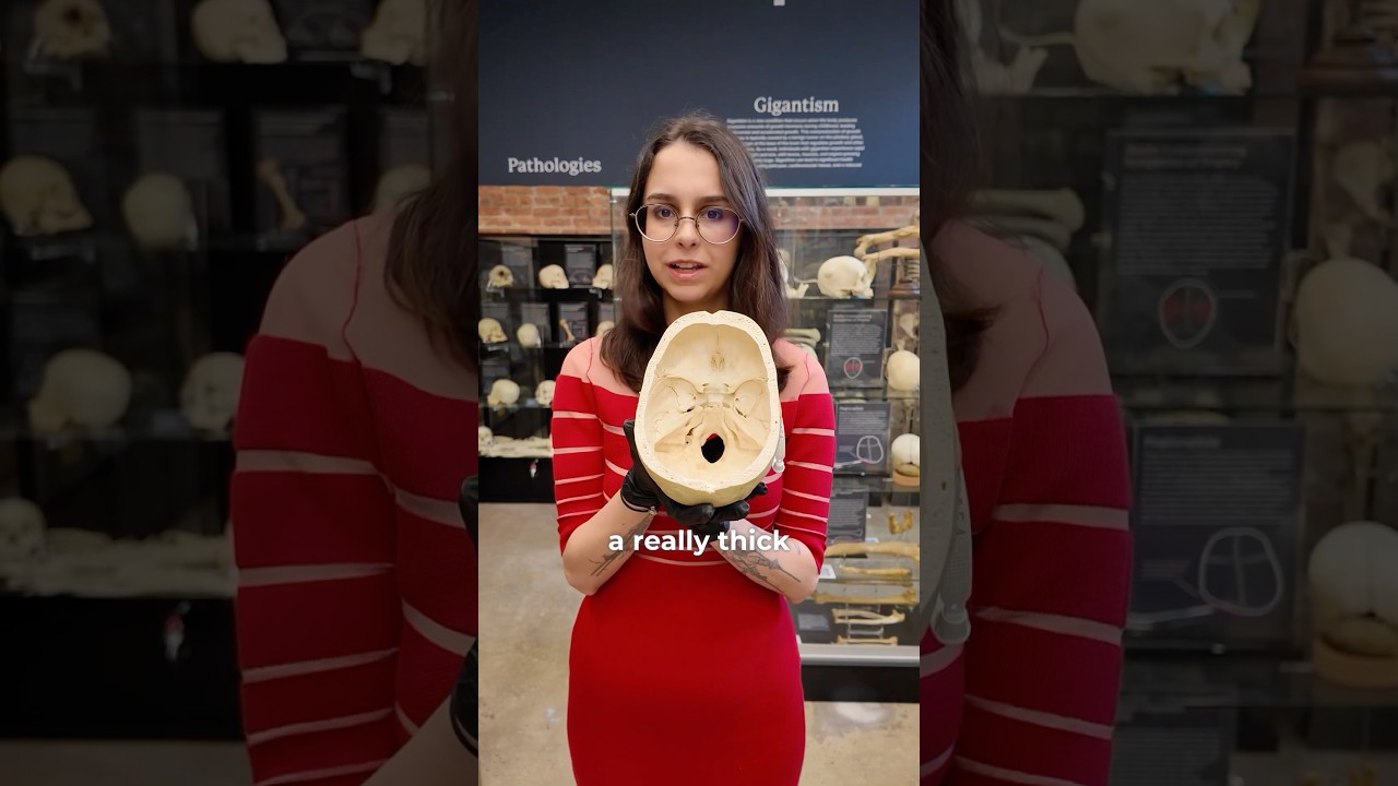 Rare pieces in the bone museum part 234 ￼