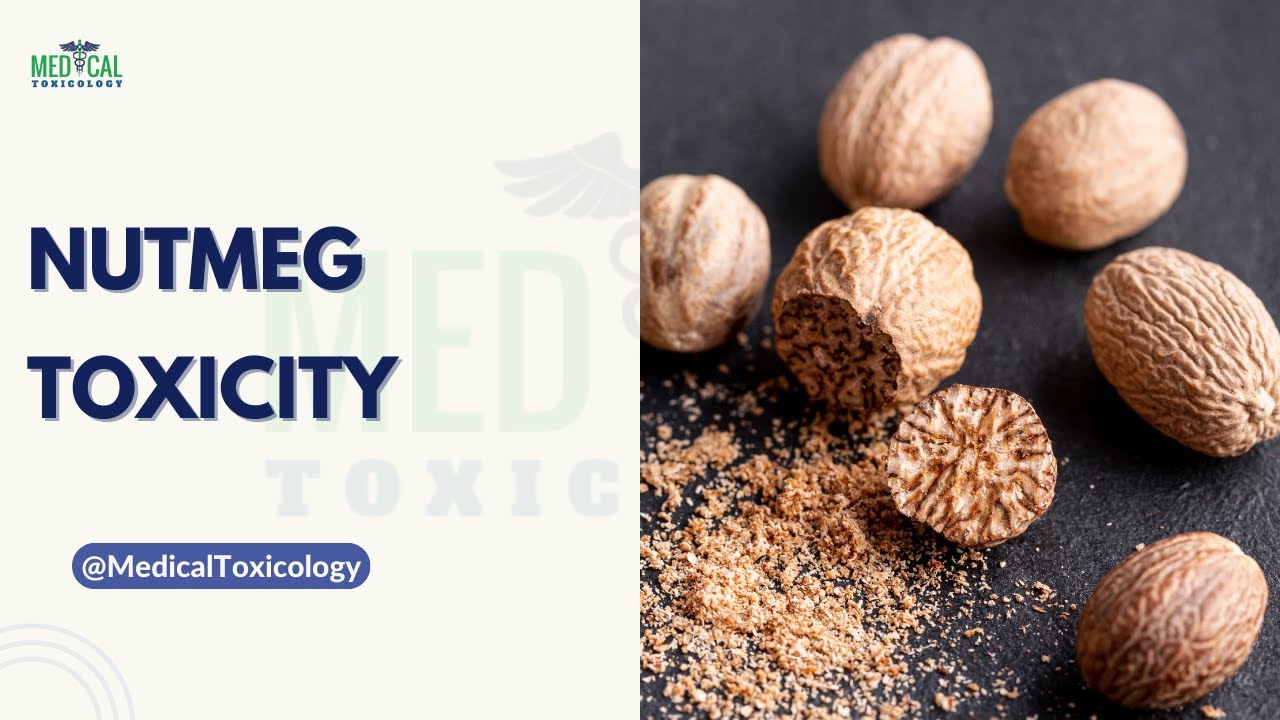 Nutmeg Toxicity and Psychoactive Effects