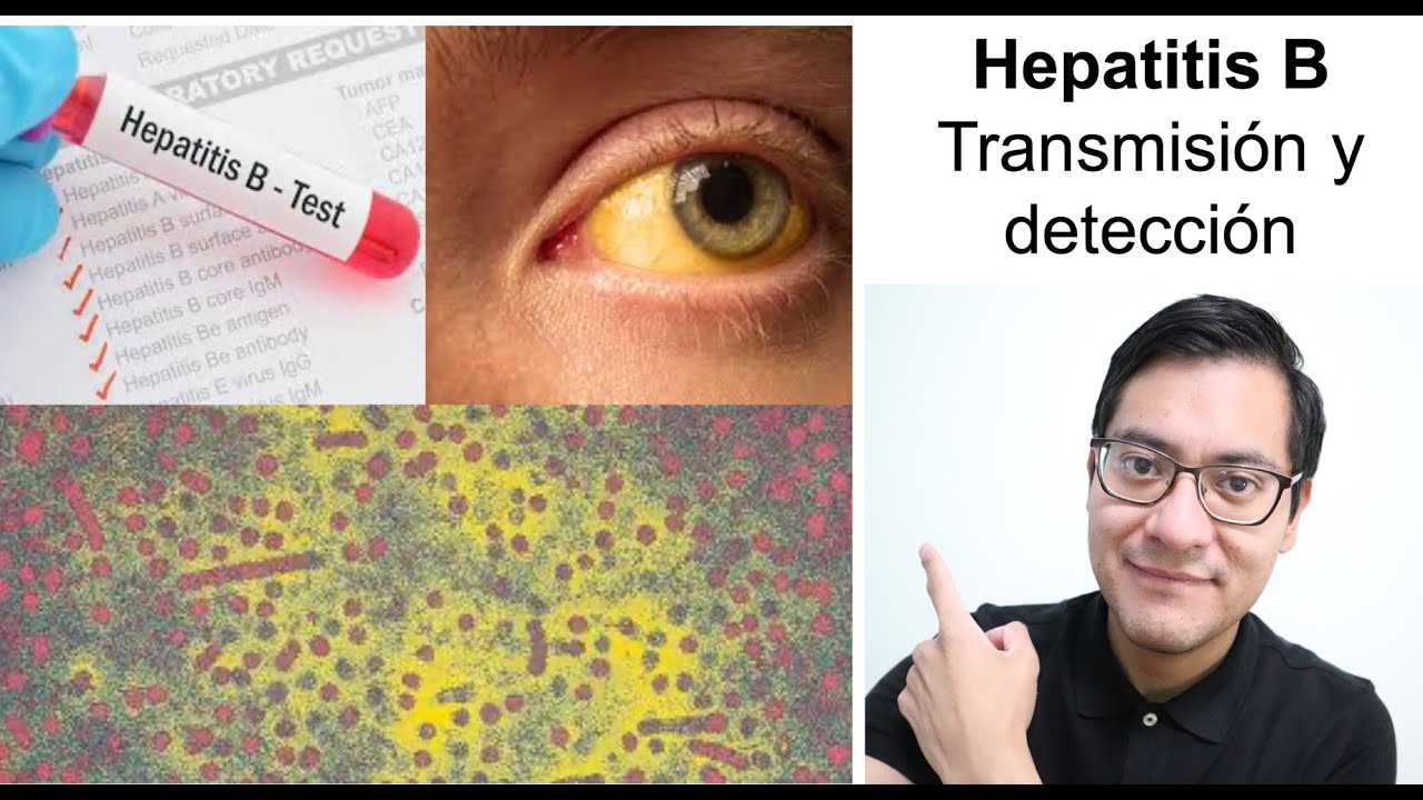 Hepatitis B: Transmisión y Diagnóstico.