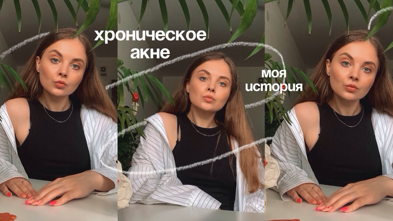 Хроническое Акне (прыщи) | Ремиссия | Рецидив | Непринятие | Моя история