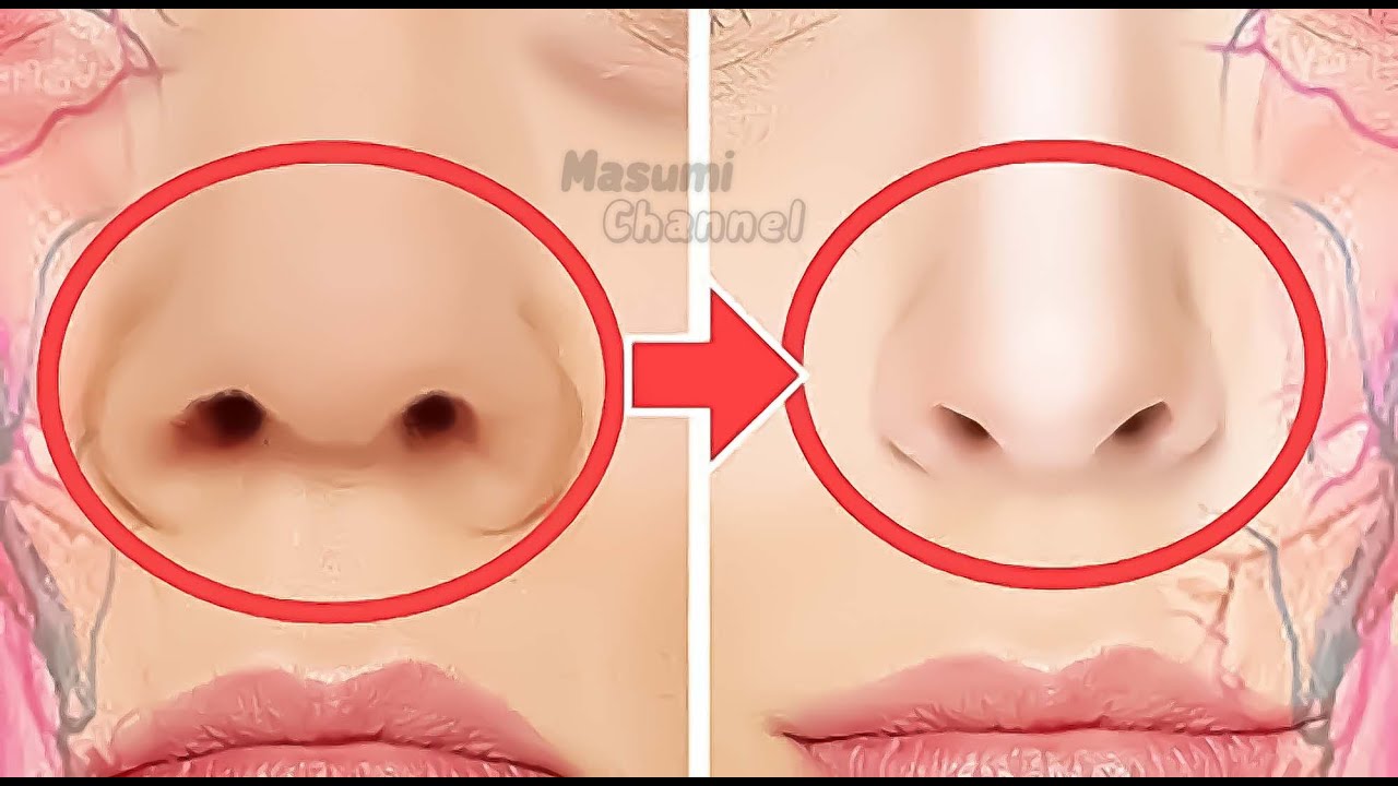 SLIM NOSE EXERCISES! Make Nose Smaller, Sharper | Fix Fat, Round Nose | Slim Down Your Nose Fat
