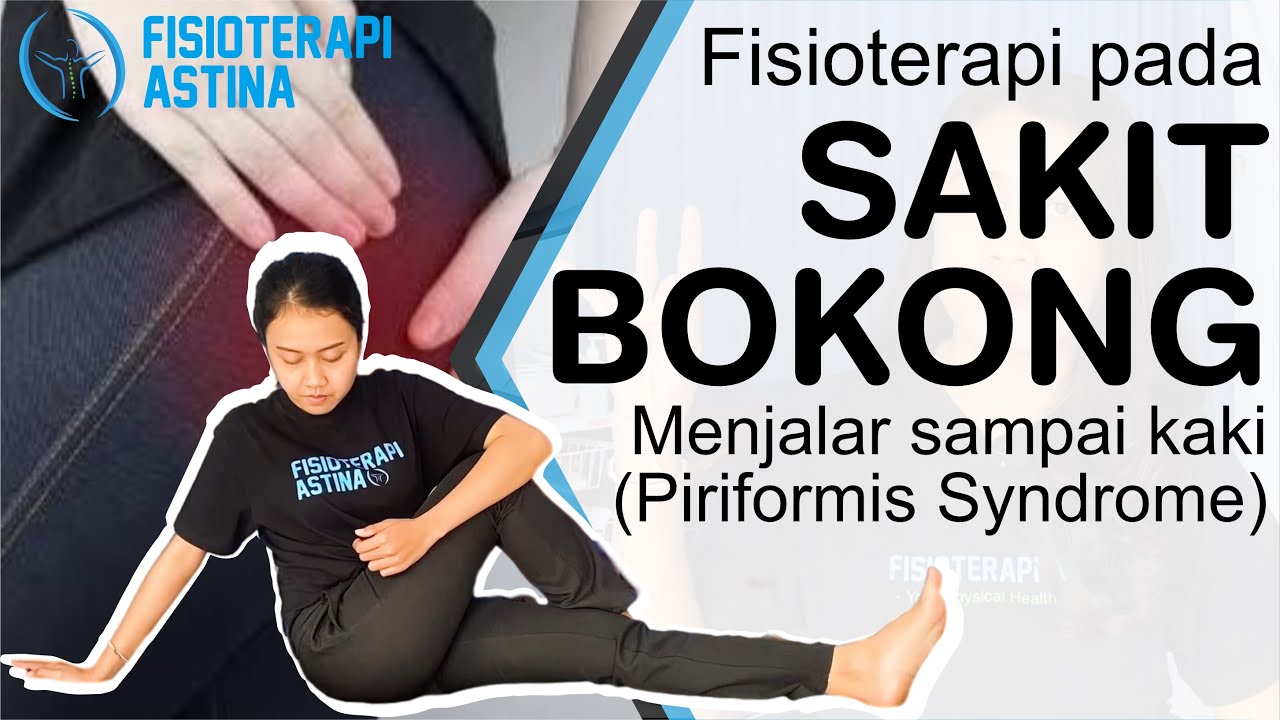 Cara Mengatasi Sakit Bokong | Fisioterapi Nyeri di Bokong Belakang (Piriformis Syndrome)