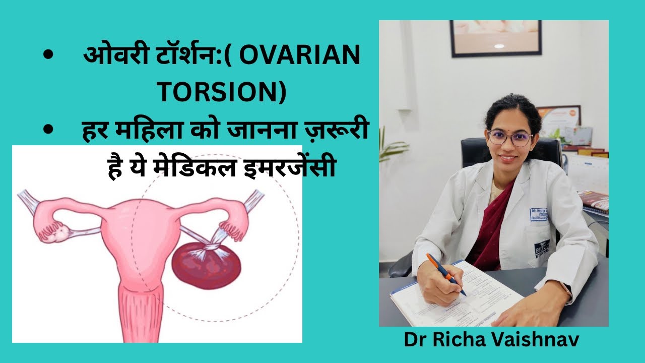 OVARIAN TORSION # Twisting of ovarian # complications of ovarian cyst #ओवरी टॉर्शन