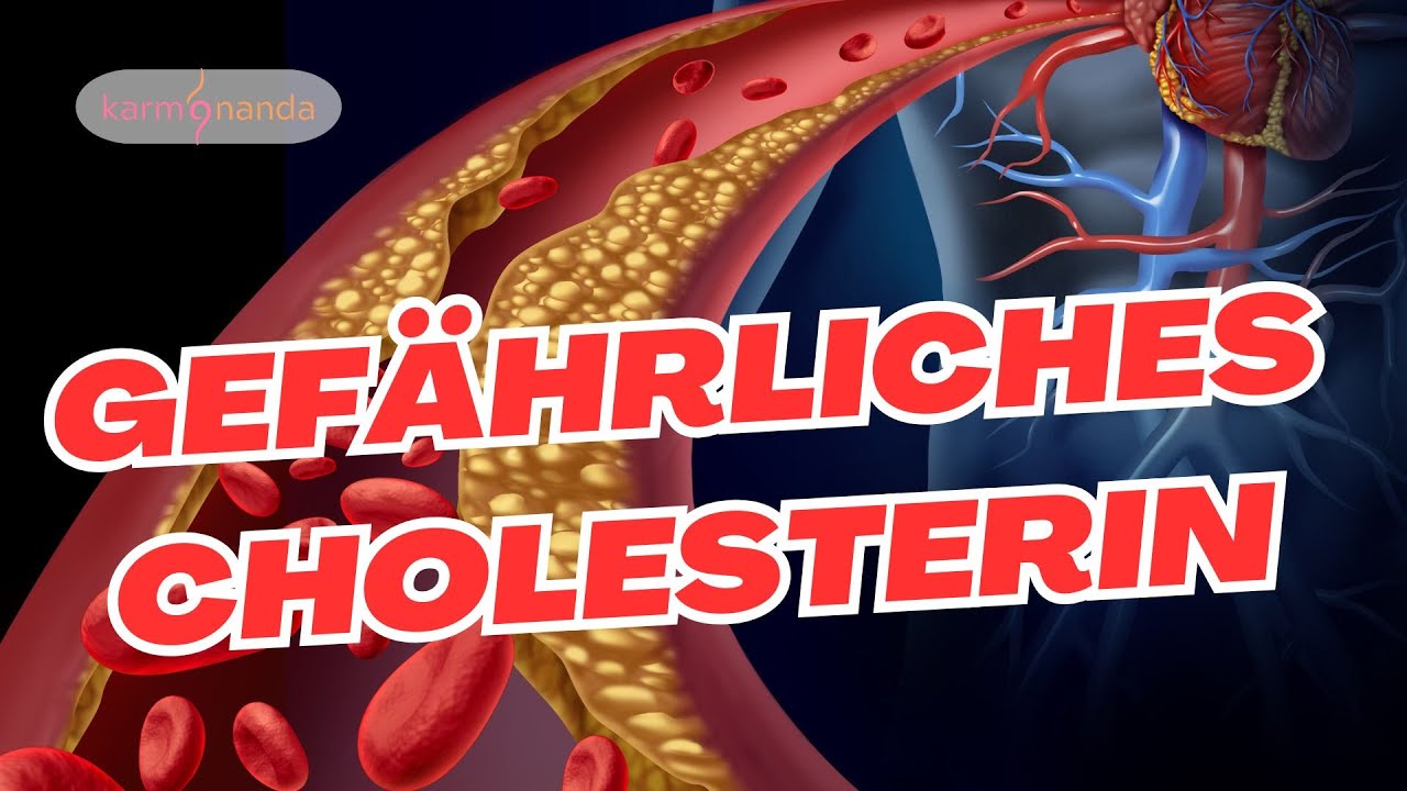 Die Cholesterin-L&uuml;ge? Was du wissen solltest