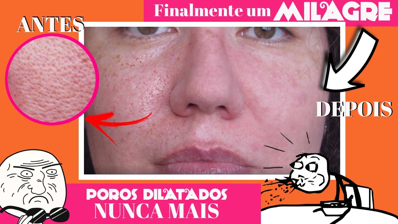 MELHOR PRIMER E BASE PARA POROS DILATADOS [COM ANTES E DEPOIS]
