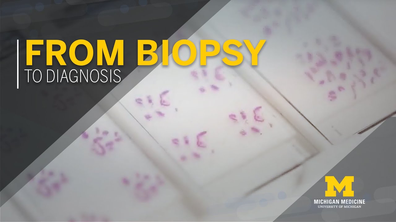 From Biopsy to Diagnosis