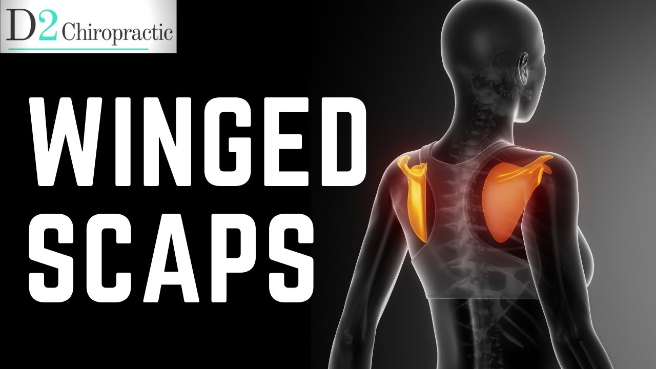 Winging Scapulae : Serratus Anterior & Lower Trap Strengthening