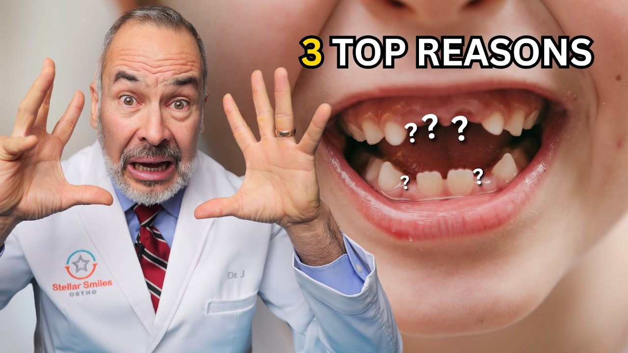 Why Baby Teeth Aren’t Falling Out & What to Do!