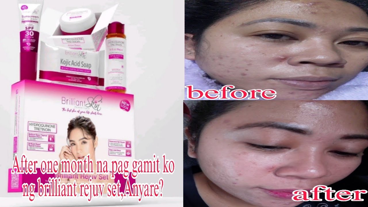 Brilliant Skin rejuv set anong nangyari sa face ko after one month?#products review@atienzaanna2435 