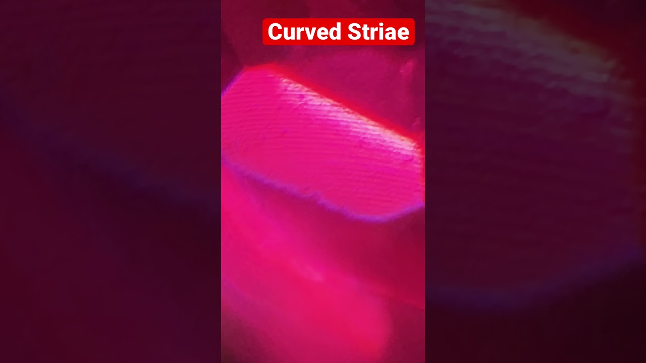 Natural Ruby Or Lab Created? How Would You Know?! Capturing Curved Striae Under the microscope 🔬
