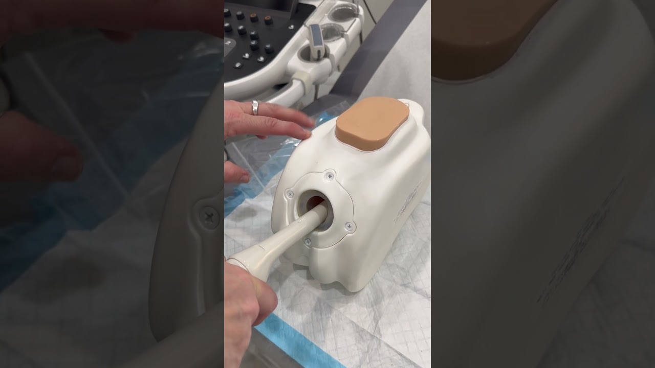 Have you had a transvaginal ultrasound?