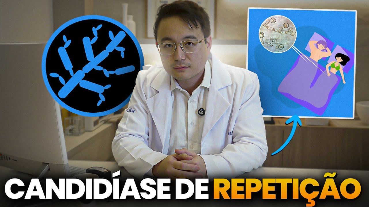 Candidíase sempre volta? Seu parceiro pode ser a causa (mesmo sem sintomas) | Dr. Wilson Sato