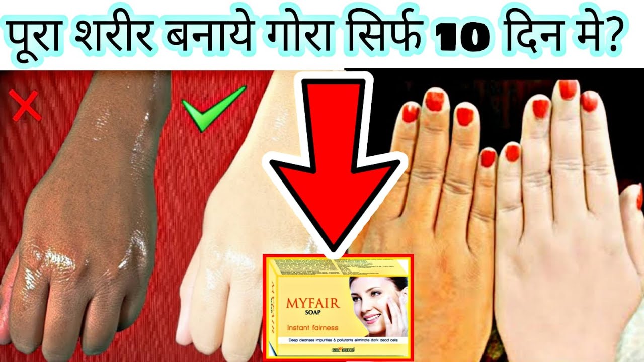 Full Body Whitening Rs.35/- | Skin Whitening Soap | Myfair Soap | Skin Lightening Soap | 100% Result