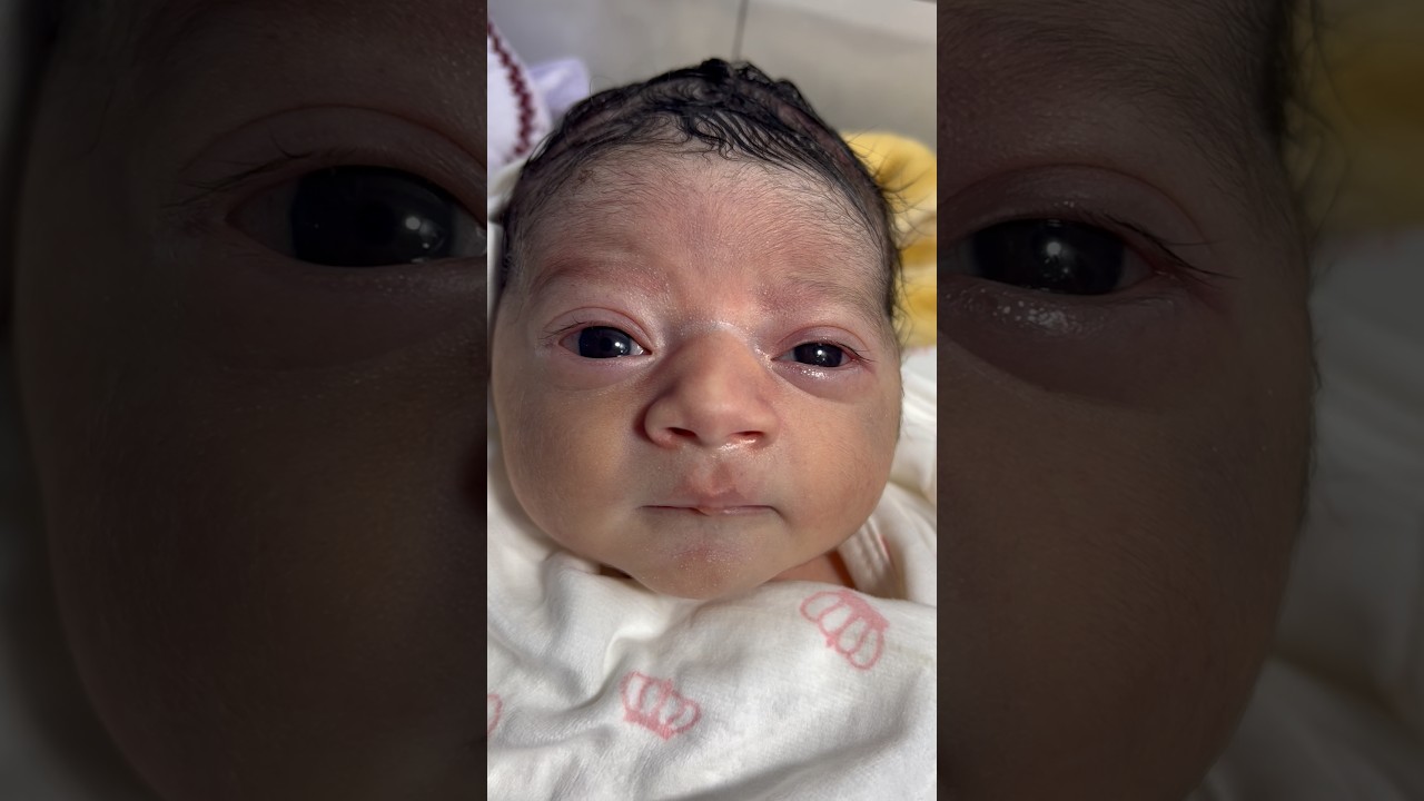 Cute Just-Born NICU Baby Receiving Warmth & Care 👶🤲❤️ #NICUBaby #NewbornCare🤲🙏❤️