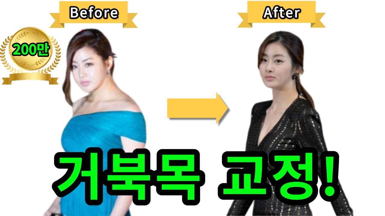 거북목 교정! 화제의 200만뷰! 얼굴은 포기해도 자세만은...- 페인랩이 말하는 통증 이야기