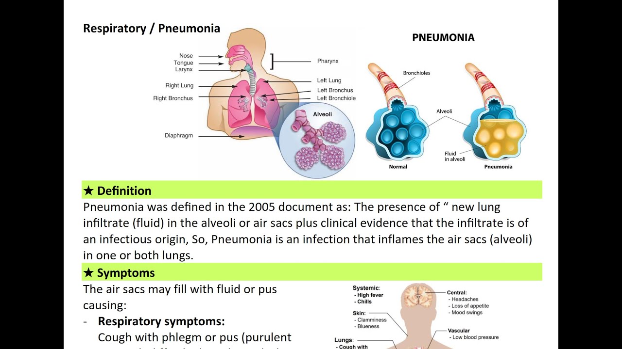 Pneumonia (Lower Respiratory Tract Infections LRTIs) الالتهاب الرئوى شرح بالعربى