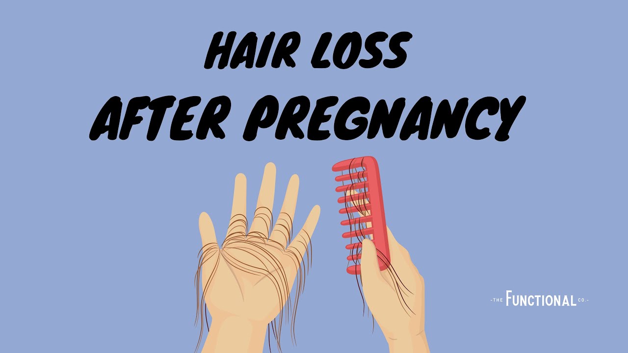 Episode 135: Hair Loss After Pregnancy