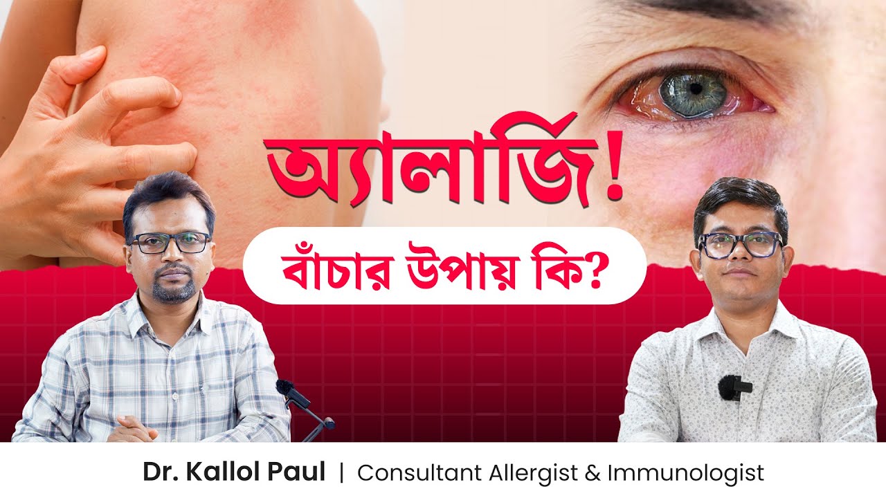 অ্যালার্জি কেন হয়? অ্যালার্জির লক্ষণ কি? অ্যালার্জি থেকে বাঁচার উপায় কি? - Dr. Kallol Paul
