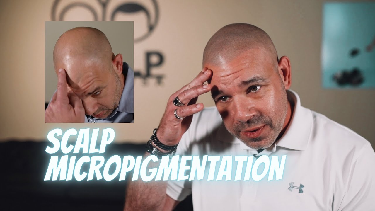 Scalp Micropigmentation Houston, Texas