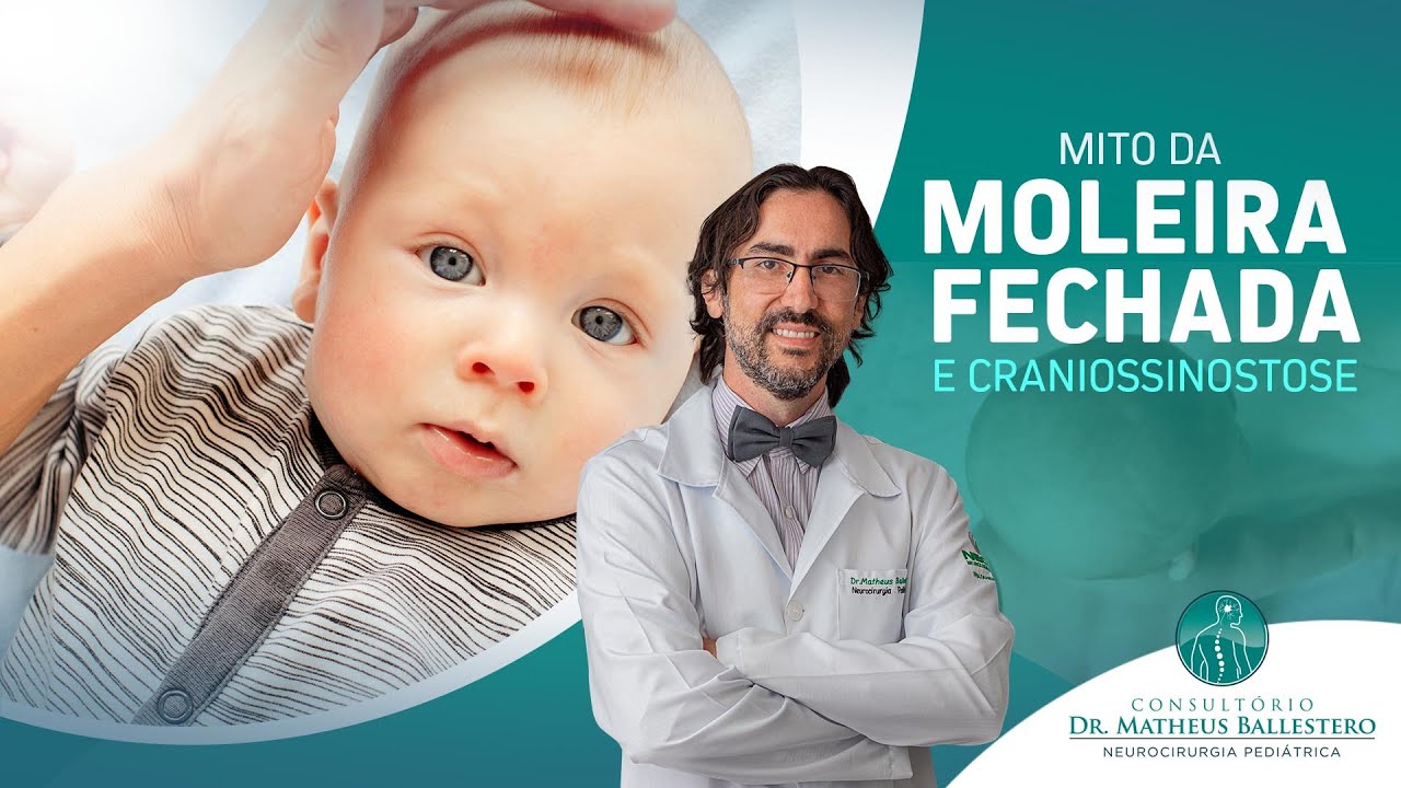 Mito da moleira fechada e Craniossinostose
