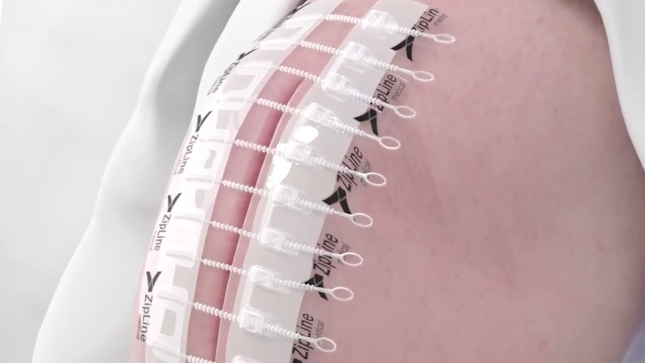 Zip Skin Closure