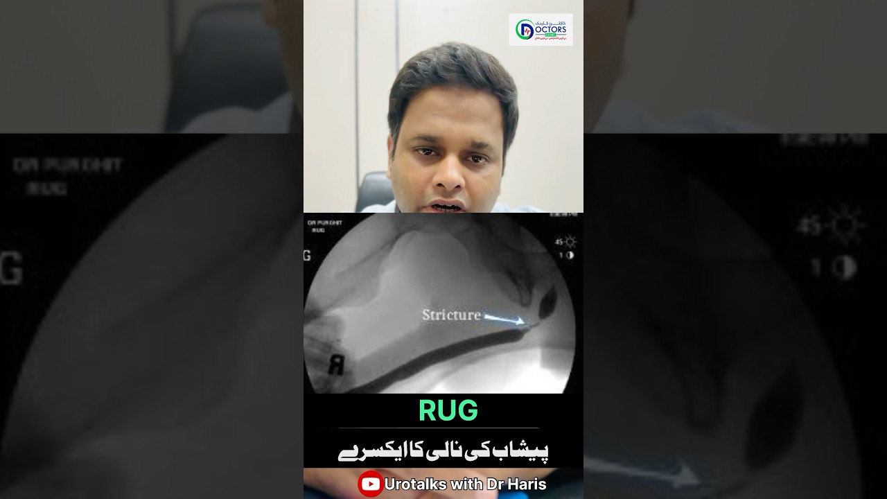 Retrograde urethrogram || Peshab ki nali ka xray #shortsfeed #shortsvideo #shortvideo #shorts
