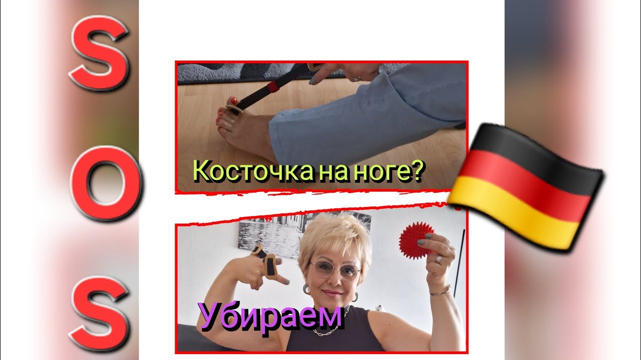 Как уменьшить косточку на большом пальце☝️МОЙ УСПЕХ!