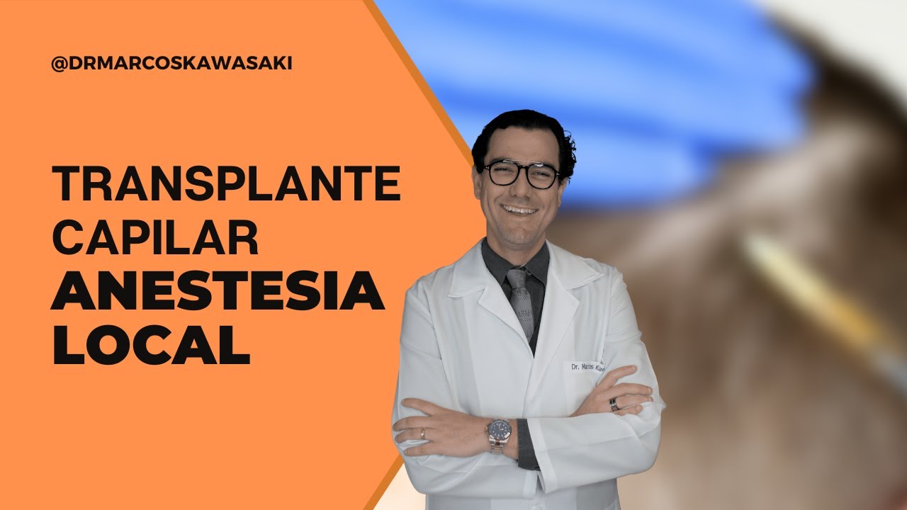 Anestesia local no Transplante Capilar
