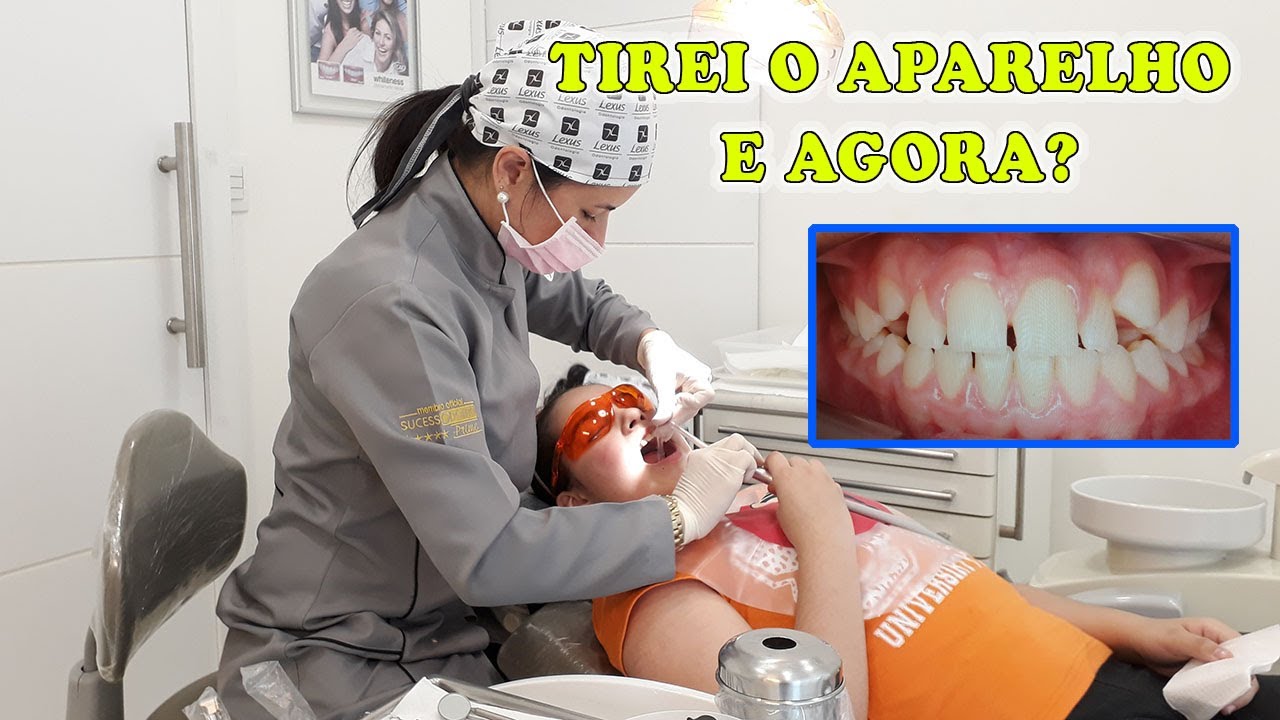 TIREI O APARELHO! Finalmente chegou o grande dia - HORA DA MARI