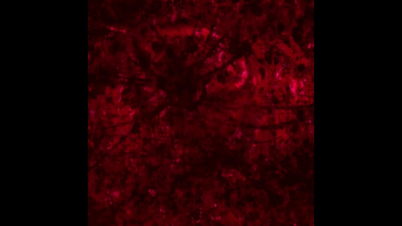 The Ballroom - CeRe:bral Atrophy - Part Four (Original Version Archive)