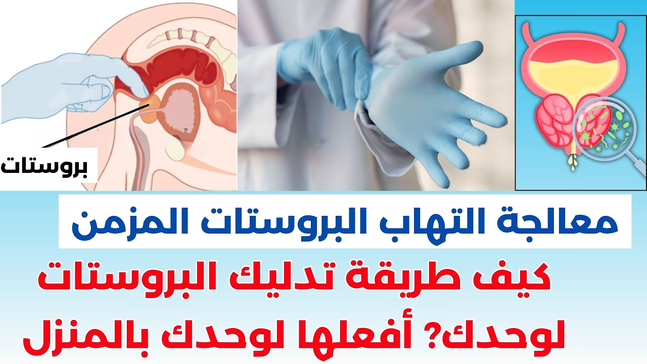 كيف طريقة تدليك البروستات لوحدك؟ معالجة التهاب البروستات؟ أفعلها لوحدك في المنزل #دكتور_جنيد_سفنج