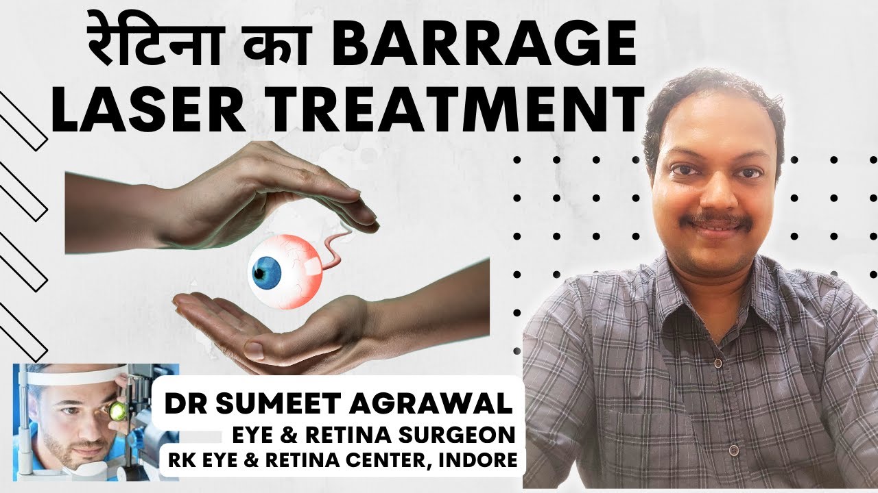 Retina के इलाज के लिए Barrage LASER.  क्यों ? कब ? कैसे ?