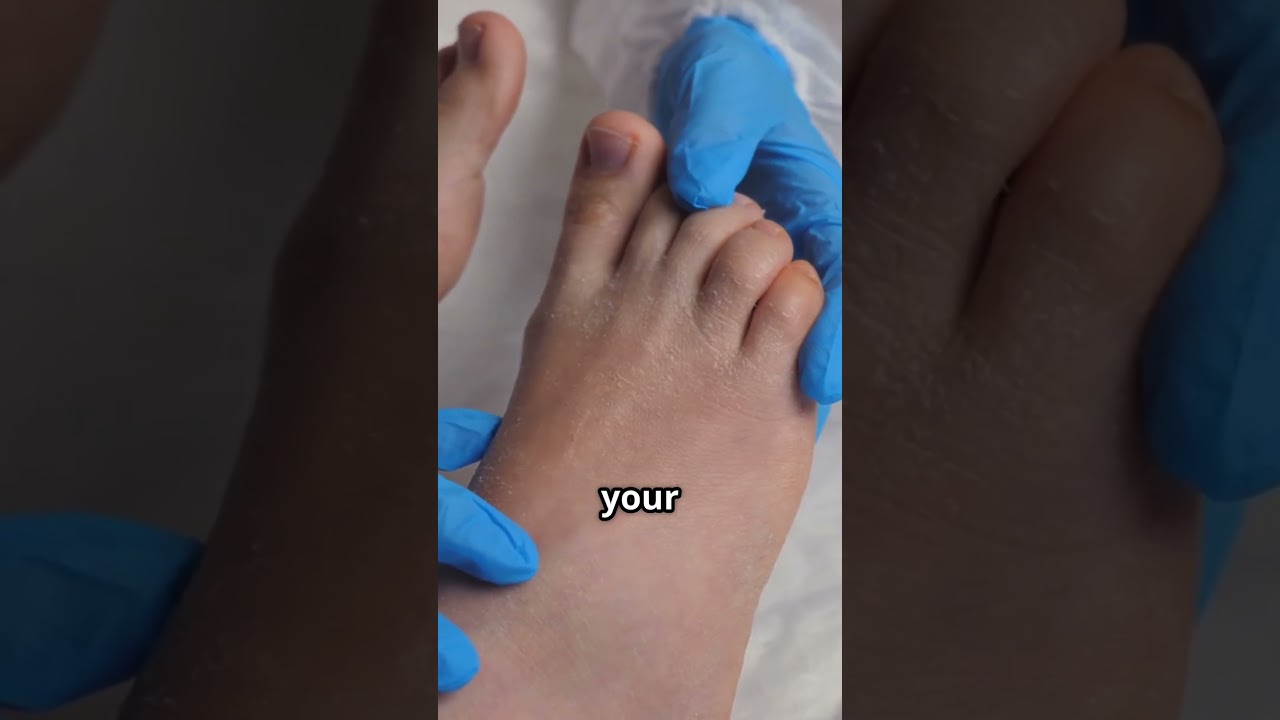 Why Your Feet Burn at Night &ndash; 5 Surprising Causes 🔥 #NerveHealth