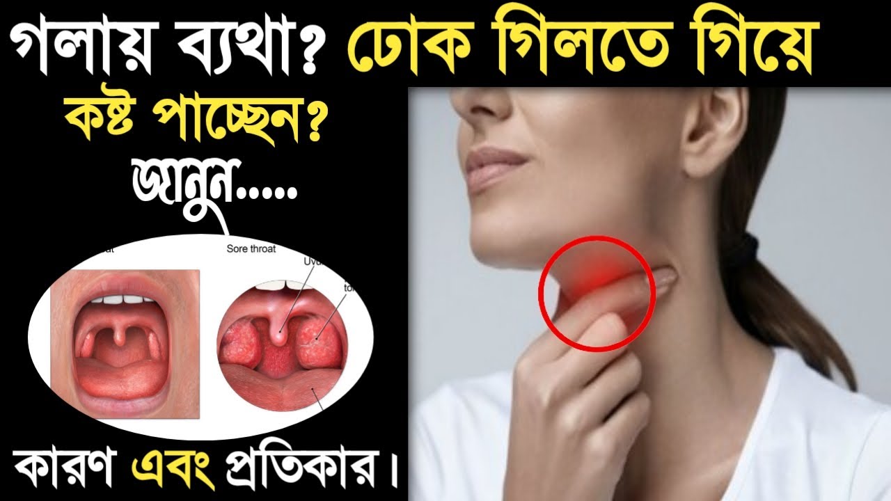 How to get rid of a sore throat - Home remedies for sore throat - What to do if sore throat - Gola betha dur korar upay
