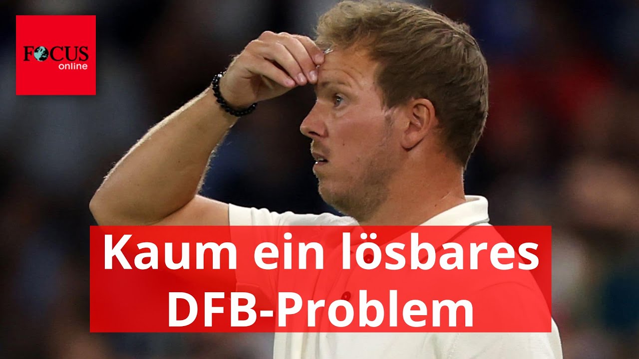 Julian Nagelsmann hat ein kaum lösbares DFB-Problem