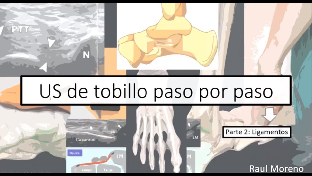 Ultrasonido de tobillo paso por paso (parte 2: ligamentos)
