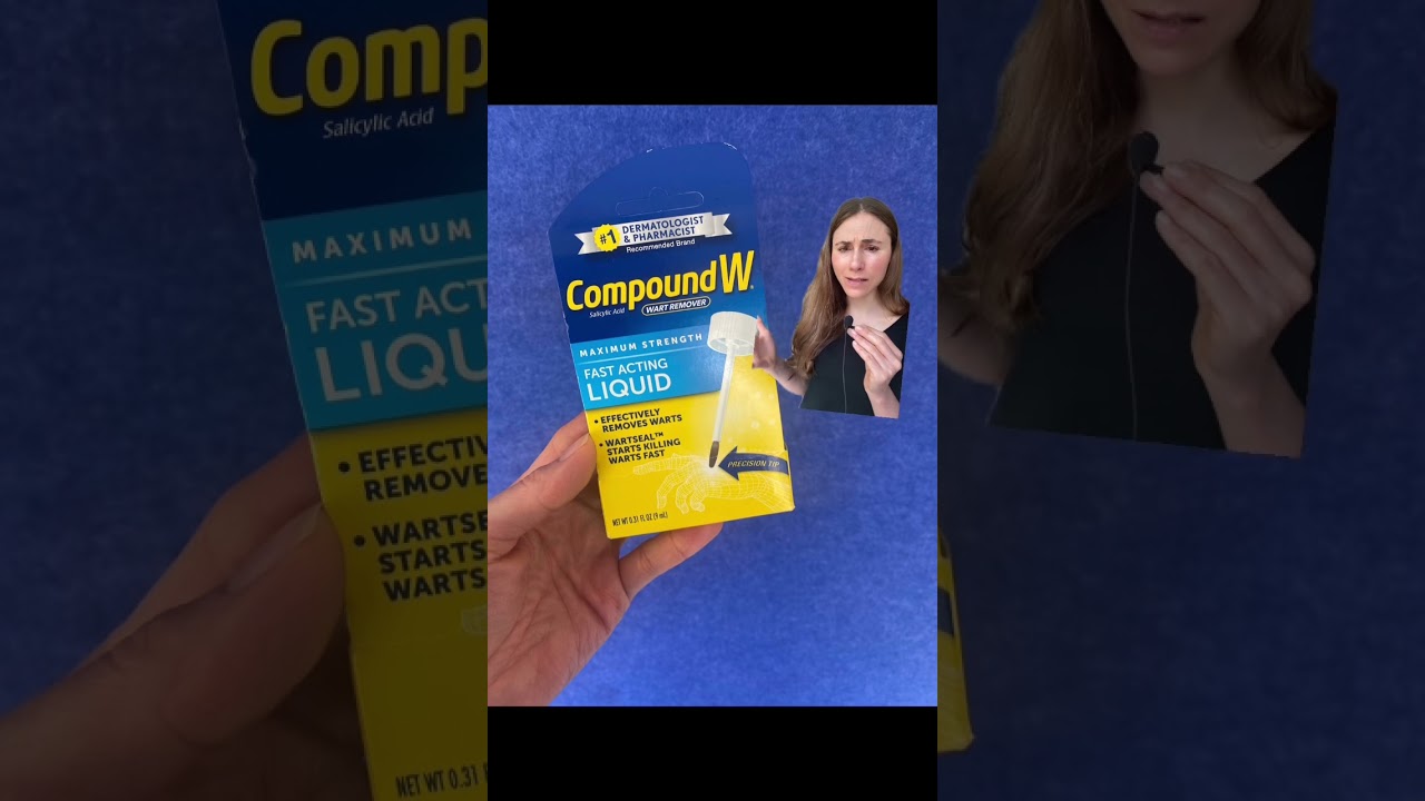 Say Goodbye To Foot Warts With These Easy Tips 🦶