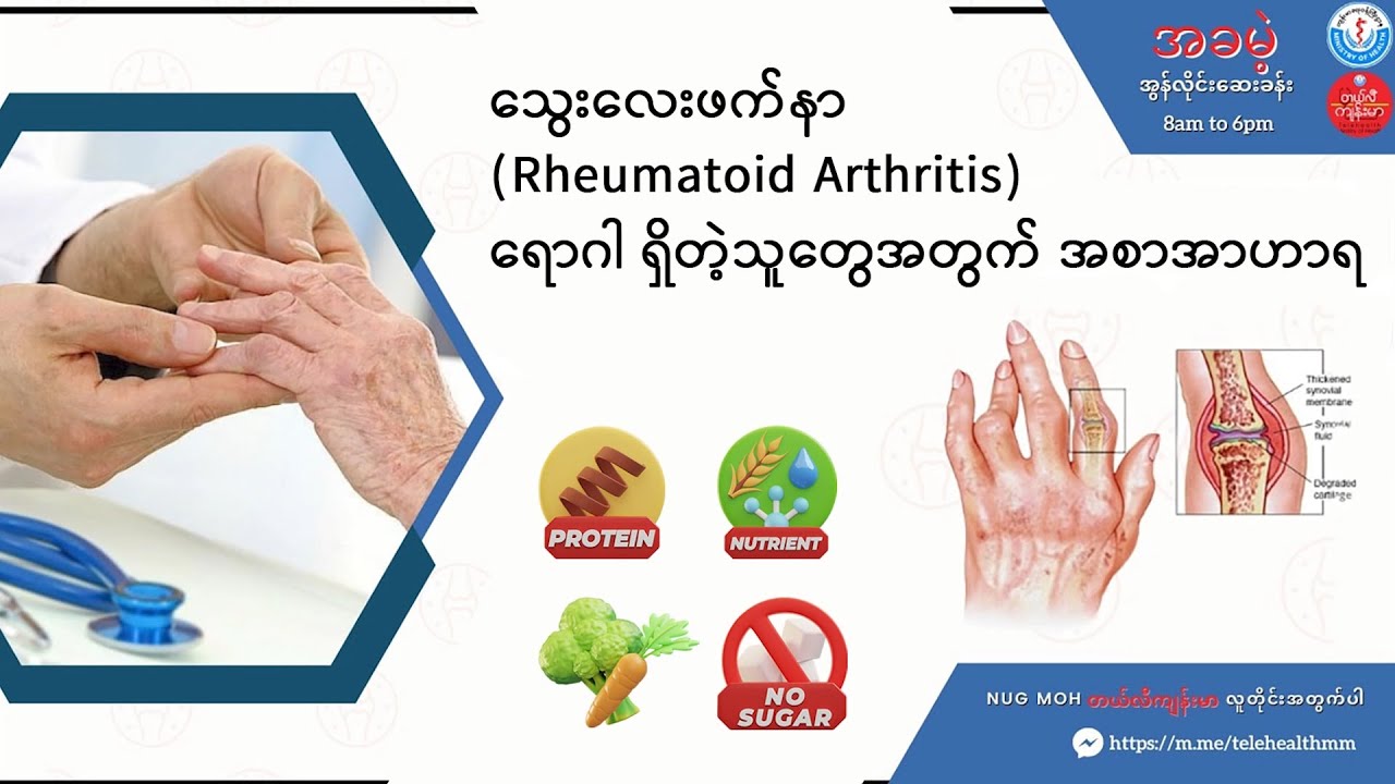 သွေးလေးဖက်နာ (Rheumatoid Arthritis) ရှိသူများအတွက် အစာအာဟာရ