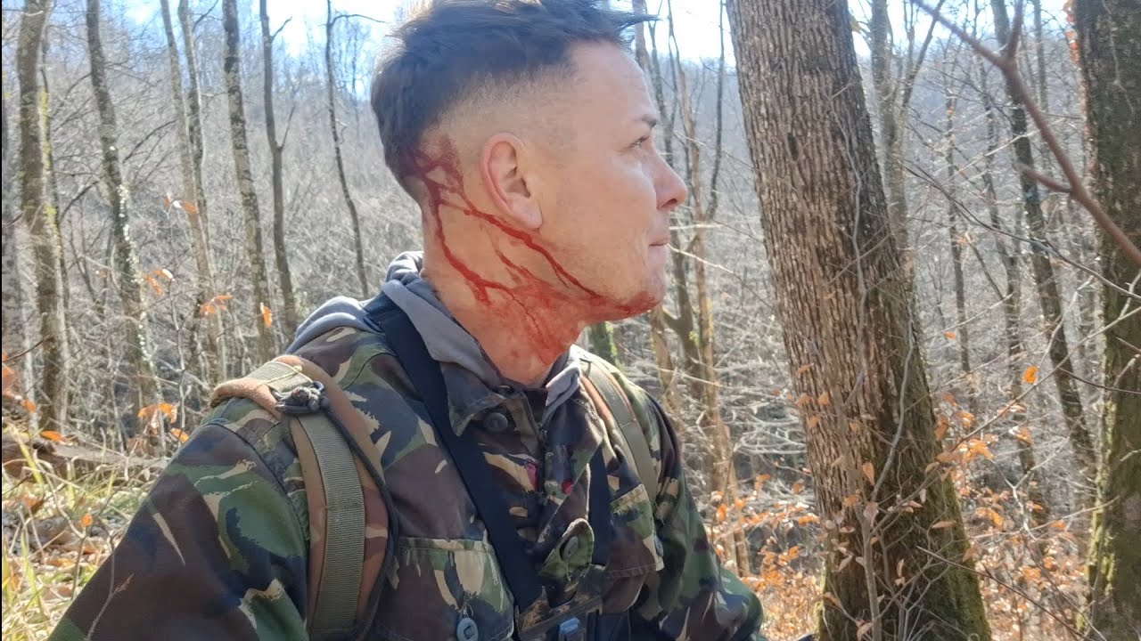 M-am accidentat la detectie si am ajuns la urgenta