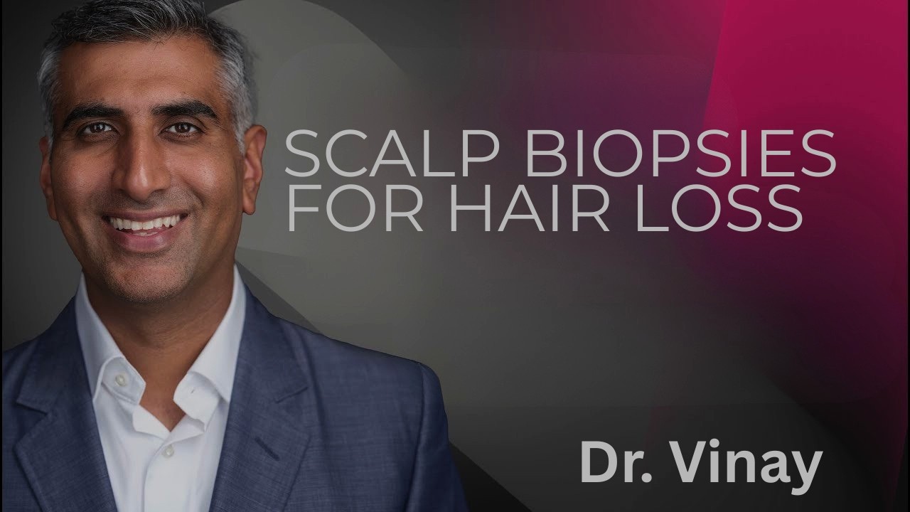 Scalp biopsies for hair loss