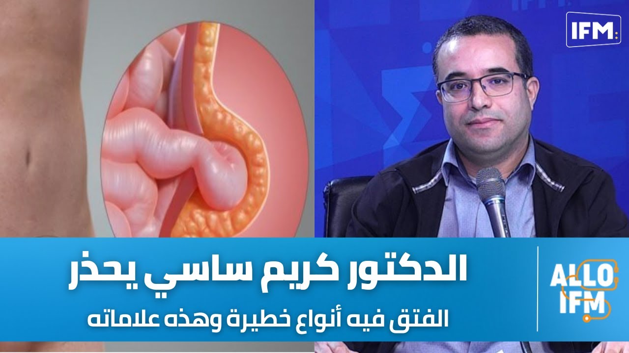 الدكتور كريم ساسي أستاذ في الجراحة العامة: الفتق فيه أنواع العادية و الخطيرة.... و هاذي علاماته