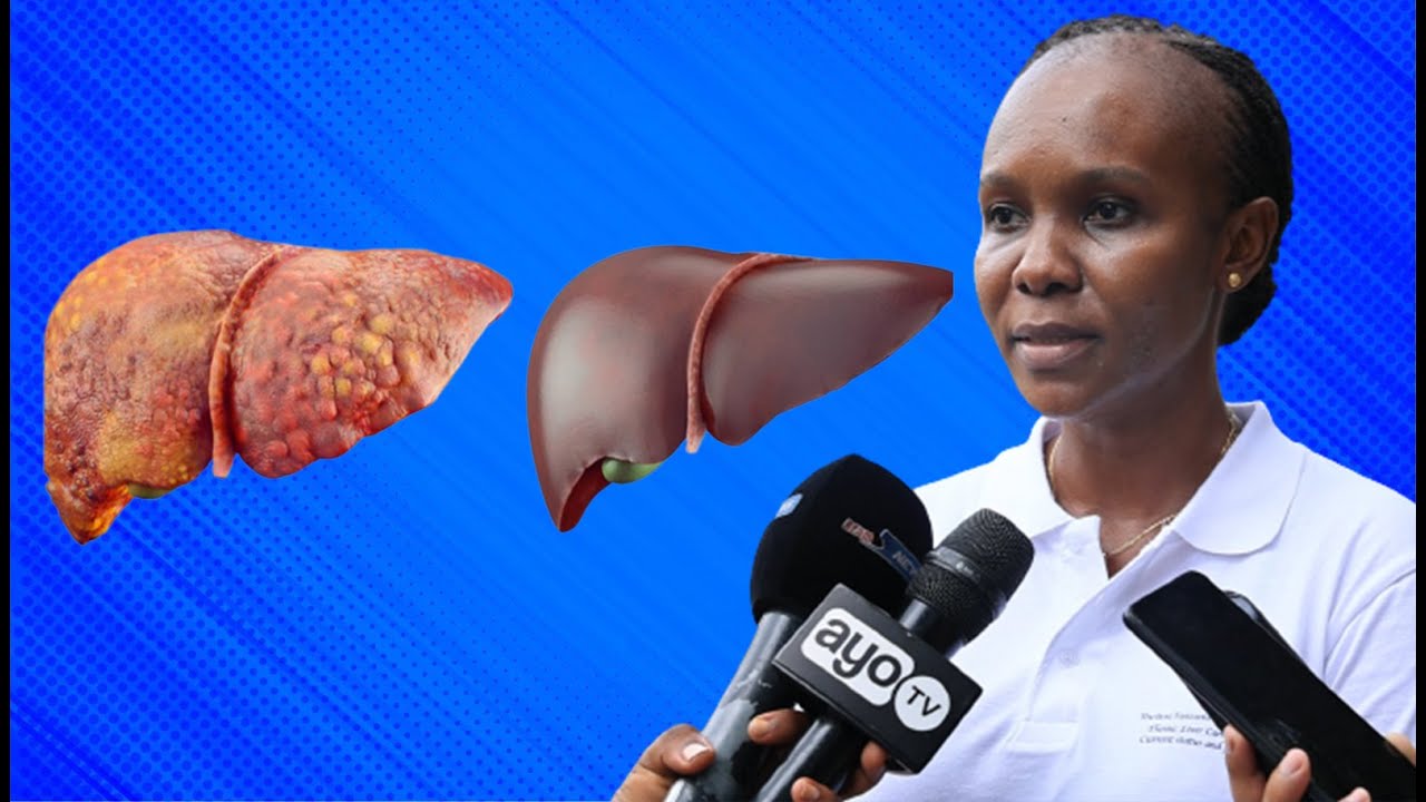 ZIJUE DALILI ZA HOMA YA INI, HUDUMA YA UPIMAJI MUHIMBILI NI BURE, DAKTARI AFUNGUKA HAYA