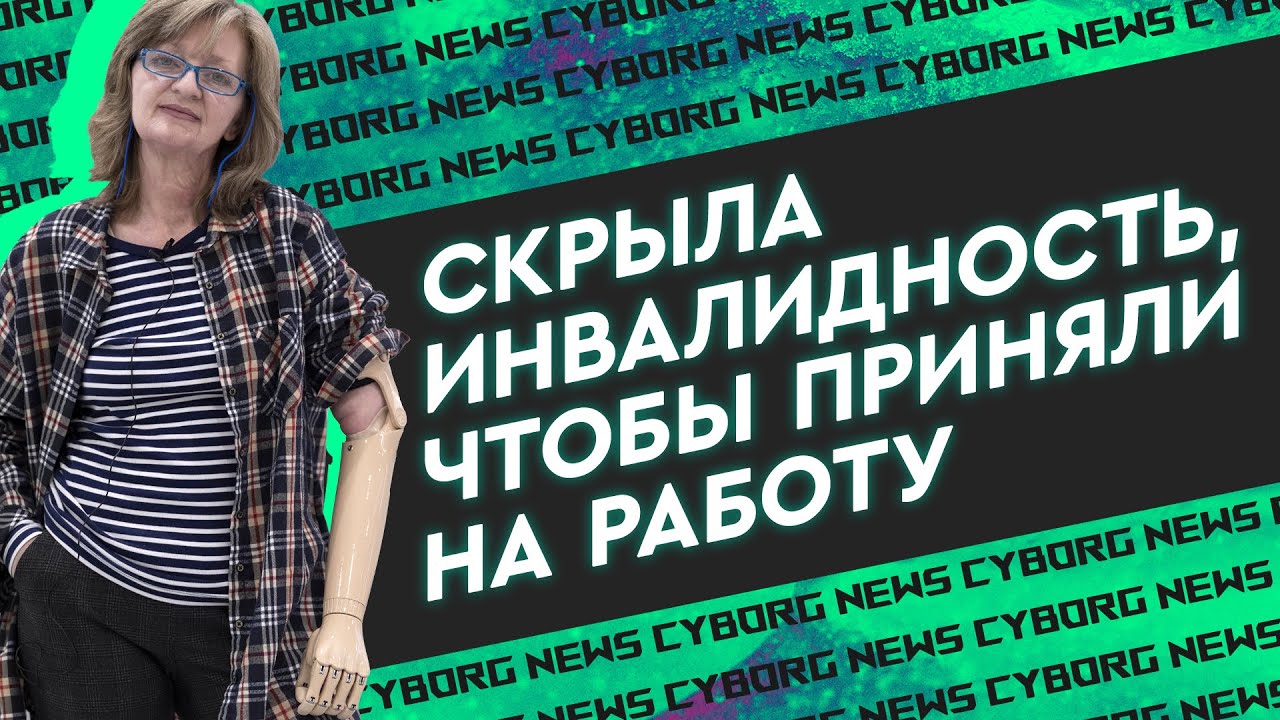 50 лет проходила с одним протезом руки, наконец-то решила обновиться. Трансплантация или Киберпанк?