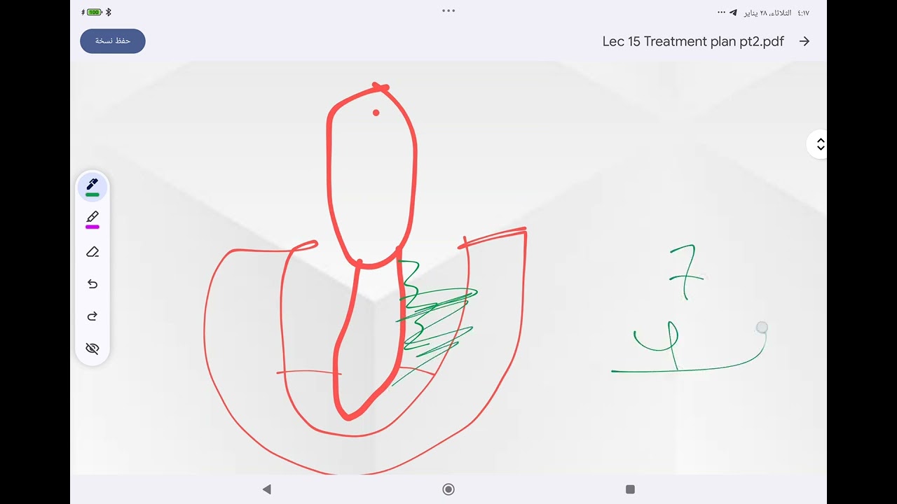 periodontology treatment plan( scaling and root planing and chemical plaque control)  أسنان رابعة