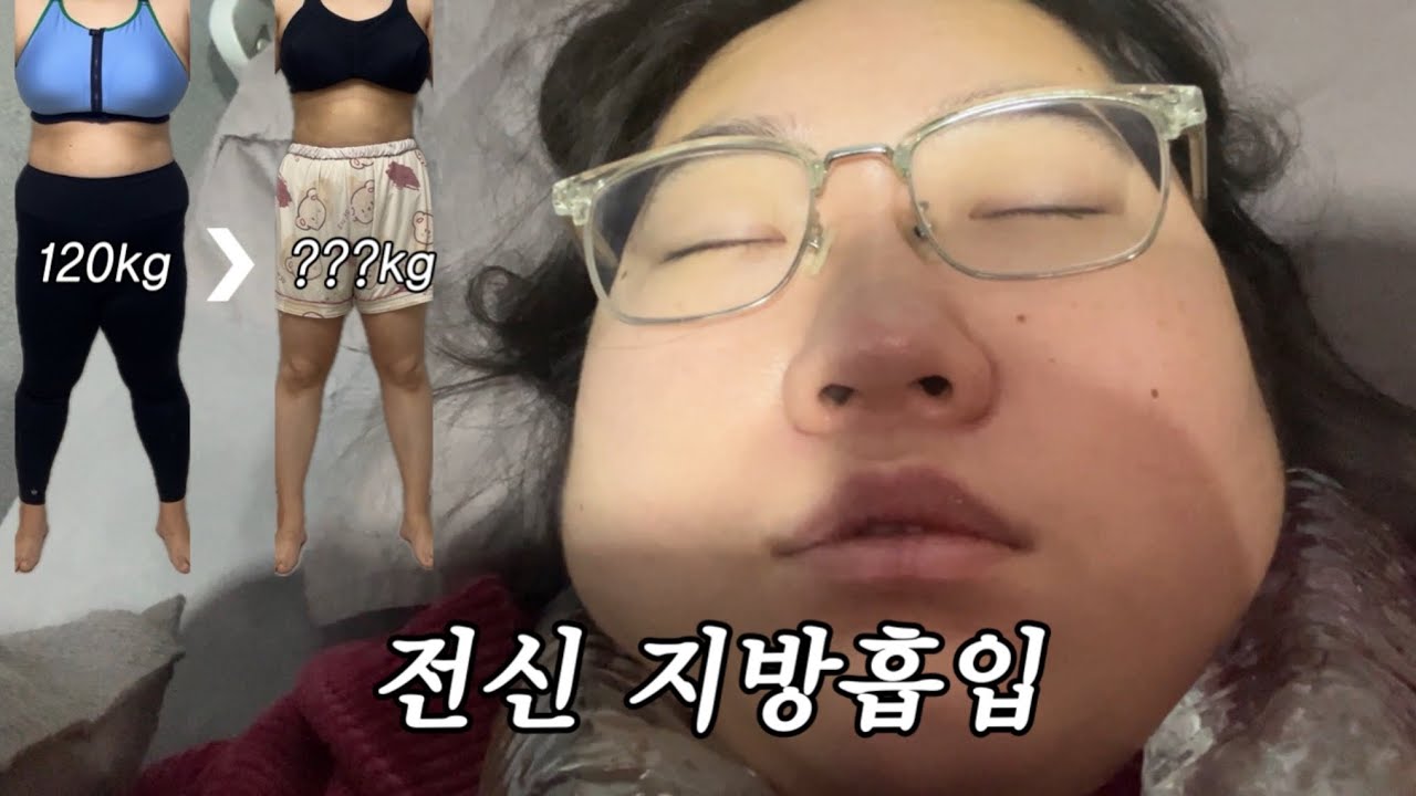 전신 지방 흡입 했습니다