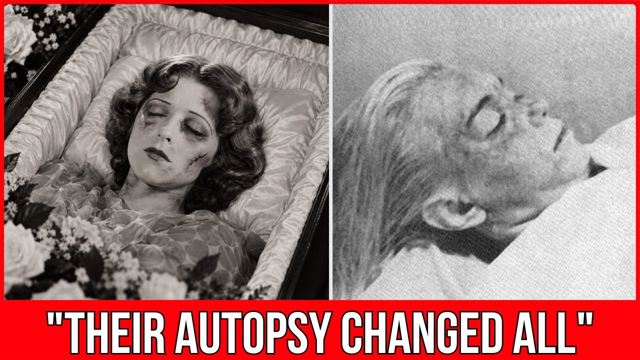 18 Shocking Secrets Revealed in Golden Age Hollywood Autopsies