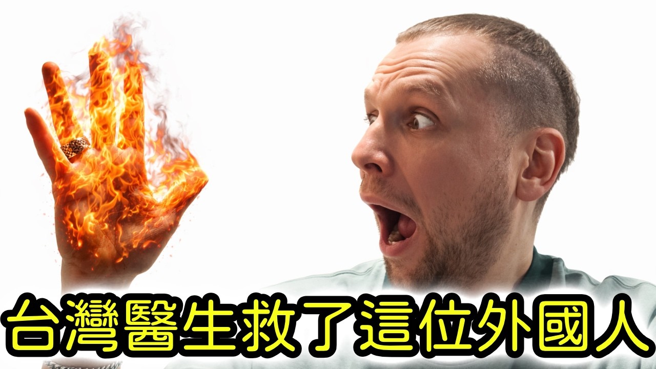 外國人在台灣被燒傷！不敢相信台灣的急診室。How I got burned in Taiwan.