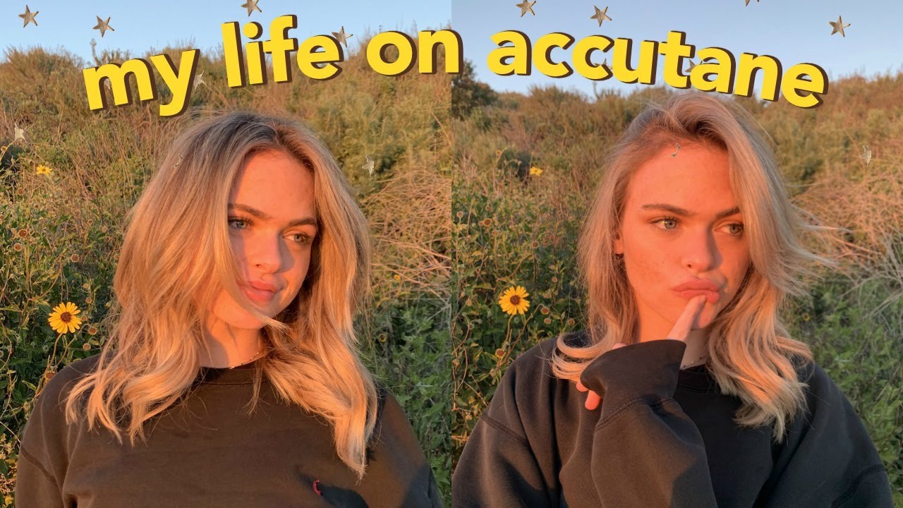 a day in the life on accutane + updated skincare routine! | Summer Mckeen
