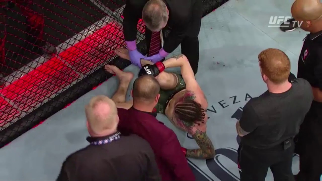 UFC 222 Sean O'Malley Injures His leg