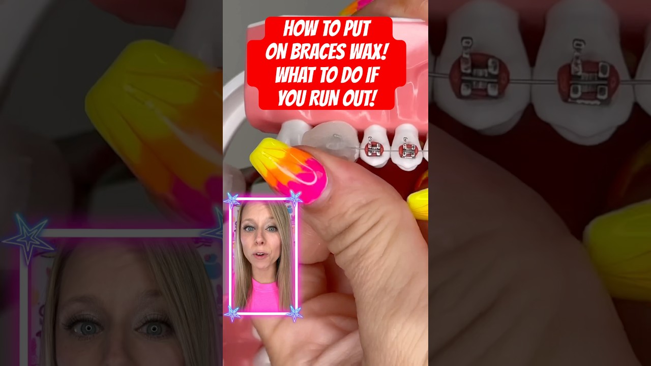 HOW TO PUT ON BRACES WAX *what to do if you HAVE NONE! #braces #wax #asmr
